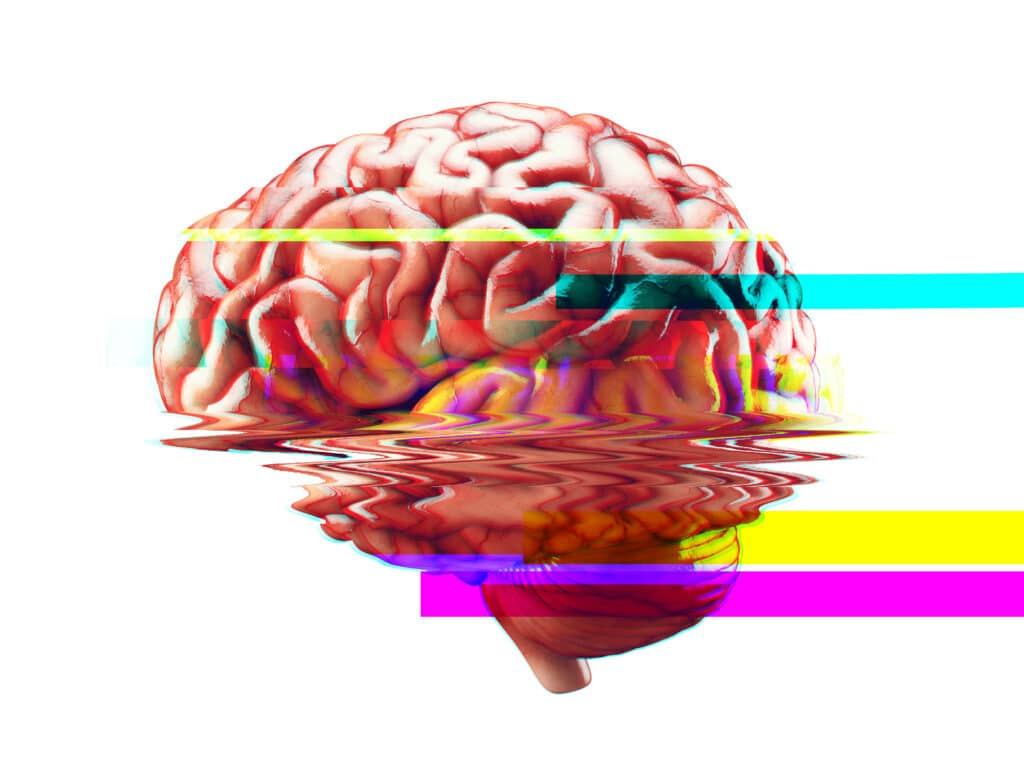 A digital artwork of a human brain with a glitch effect. The brain appears to be distorted with horizontal neon-colored lines in pink, yellow, and blue, creating a dynamic and abstract visual against a white background.